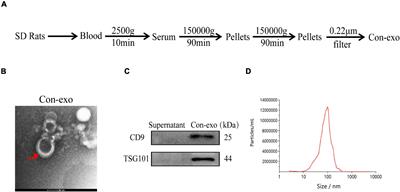 Healthy Serum-Derived Exosomes Improve Neurological Outcomes and Protect Blood–Brain Barrier by Inhibiting Endothelial Cell Apoptosis and Reversing Autophagy-Mediated Tight Junction Protein Reduction in Rat Stroke Model